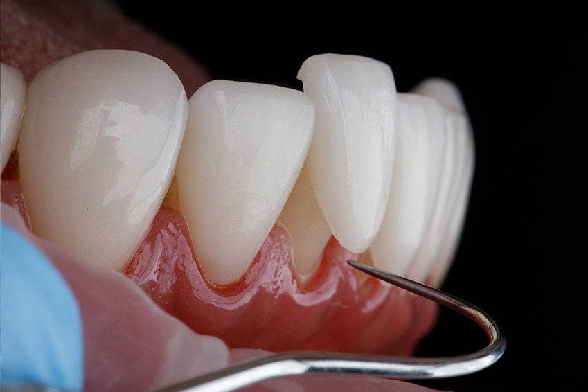 Marino Family Dental | Restorative Treatments, Family Dentistry and Professional In-Office Teeth Whitening