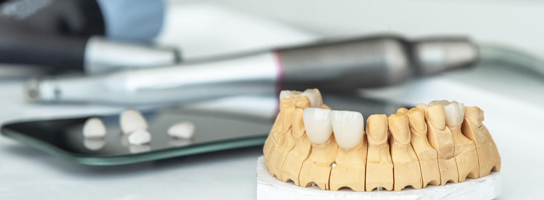 Marino Family Dental | Root Canals, Cosmetic Dentistry and Ceramic Crowns