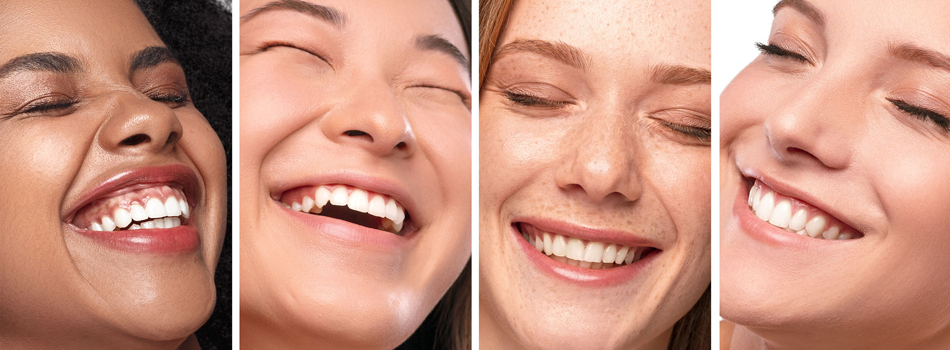 Marino Family Dental | Veneers, Restorative Treatments and Implant Dentistry