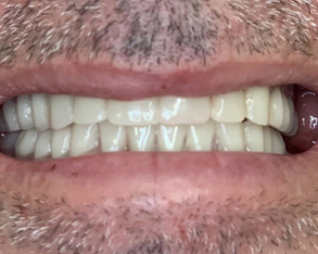 Marino Family Dental | Teeth Whitening, Oral Exams and Restorative Treatments