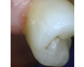 Marino Family Dental | Restorative Treatments, Teeth Whitening and Sedation Dentistry