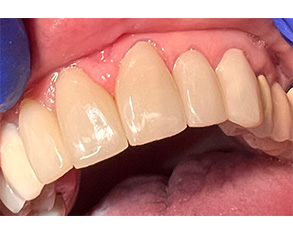 Marino Family Dental | Preventative Program, Cosmetic Dentistry and Oral Exams