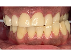 Marino Family Dental | Dentures, Emergency Treatment and Professional Denture Cleanings