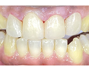 Marino Family Dental | Oral Exams, Restorative Treatments and ClearCorrect®