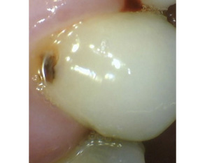 Marino Family Dental | Oral Exams, Extractions and Emergency Treatment