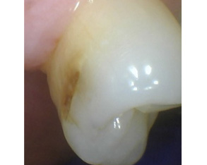 Marino Family Dental | Teeth Whitening, Preventative Program and Sedation Dentistry