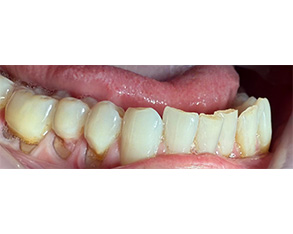 Marino Family Dental | Emergency Treatment, Cosmetic Dentistry and Periodontal Treatment