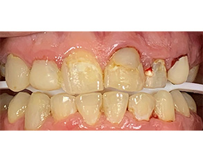 Marino Family Dental | Oral Surgery, Cosmetic Dentistry and Night Guards