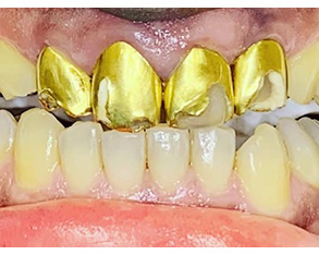 Marino Family Dental | Dental Fillings, Sedation Dentistry and Cosmetic Dentistry