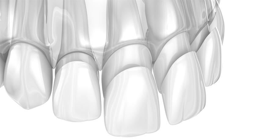 Marino Family Dental | Restorative Treatments, Dental Fillings and Emergency Treatment