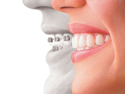 Marino Family Dental | Family Dentistry, Invisalign reg  and Periodontal Treatment
