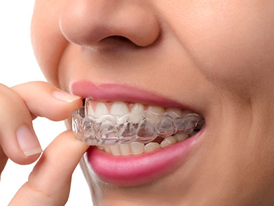 Marino Family Dental | Implant Dentistry, Invisalign reg  and Cosmetic Dentistry