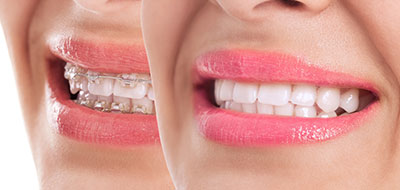 Marino Family Dental | Cosmetic Dentistry, Oral Exams and Sedation Dentistry