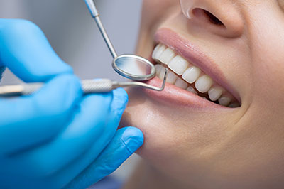 Marino Family Dental | Sedation Dentistry, Teeth Whitening and Preventative Program