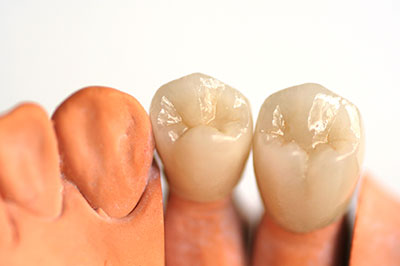 Marino Family Dental | Family Dentistry, Preventative Program and Veneers