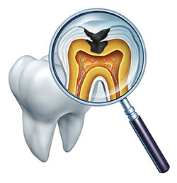Marino Family Dental | Family Dentistry, Teeth Whitening and Preventative Program
