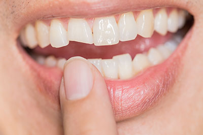 Marino Family Dental | Family Dentistry, Teeth Whitening and Veneers