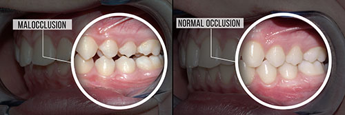 Marino Family Dental | Restorative Treatments, Implant Dentistry and Extractions
