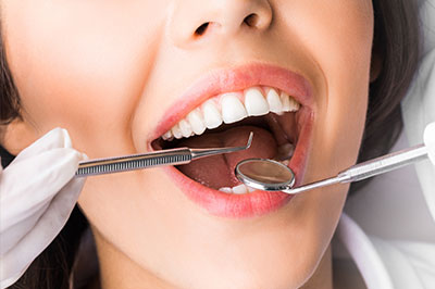 Marino Family Dental | Oral Exams, Preventative Program and Implant Dentistry