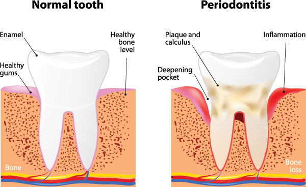 Marino Family Dental | Emergency Treatment, Veneers and Restorative Treatments