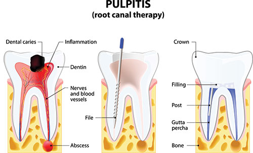 Marino Family Dental | Sedation Dentistry, Cosmetic Dentistry and Restorative Treatments