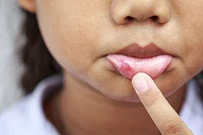 Marino Family Dental | Teeth Whitening, Family Dentistry and Implant Dentistry