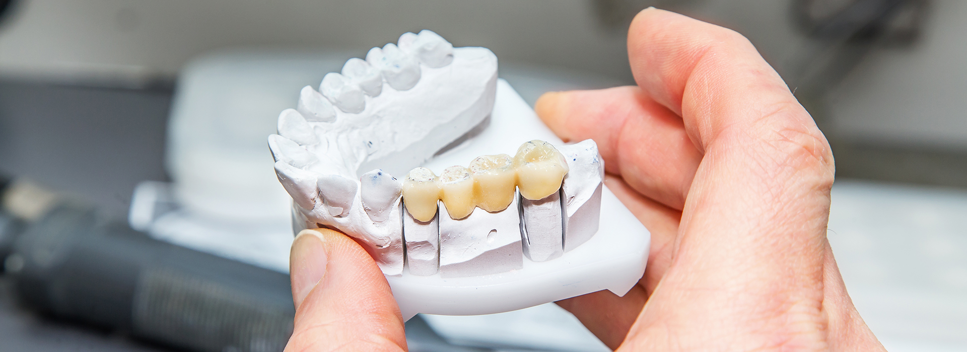 Marino Family Dental | Family Dentistry, Oral Surgery and Cosmetic Dentistry