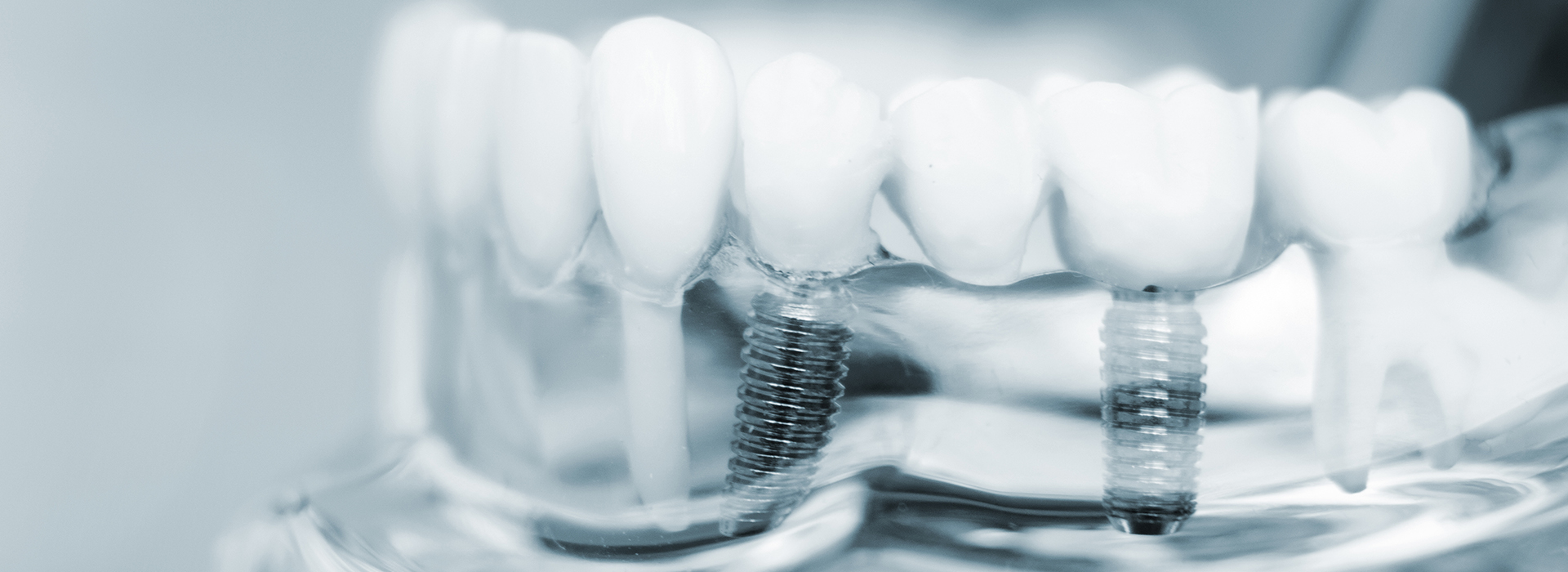 Marino Family Dental | Implant Dentistry, Cosmetic Dentistry and Family Dentistry