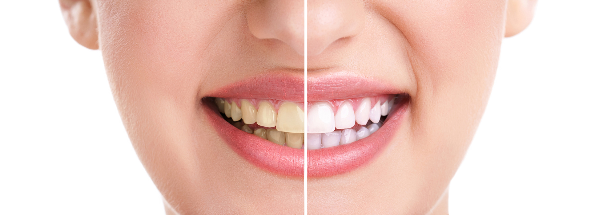 Marino Family Dental | Implant Dentistry, Family Dentistry and Preventative Program